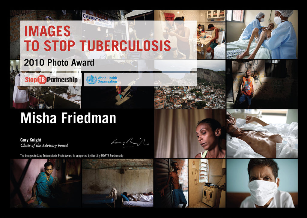 Contest fotografico – images to stop tuberculosis, attestato